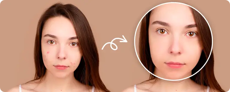 Photo Retouch